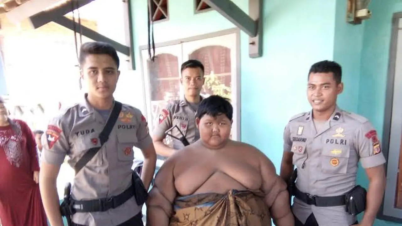 Bocah Obesitas, Arya Permana