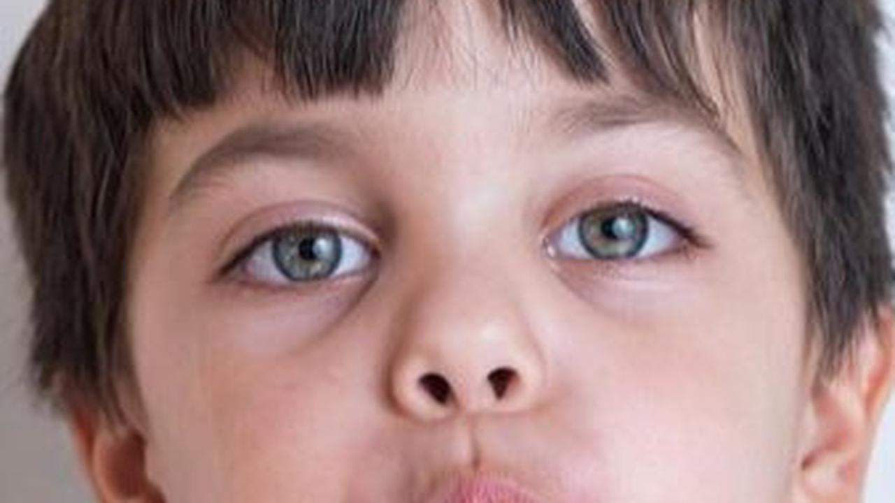 Dengan menerapkan berbagai cara di atas, diharapkan bibir kering pada bayi dan anak bisa diatasi dengan mudah. Namun, jika Si Kecil merasakan nyeri pada bibirnya, bibir anak yang kering disertai keluarnya darah, atau demam, segera konsultasikan ke dokter 