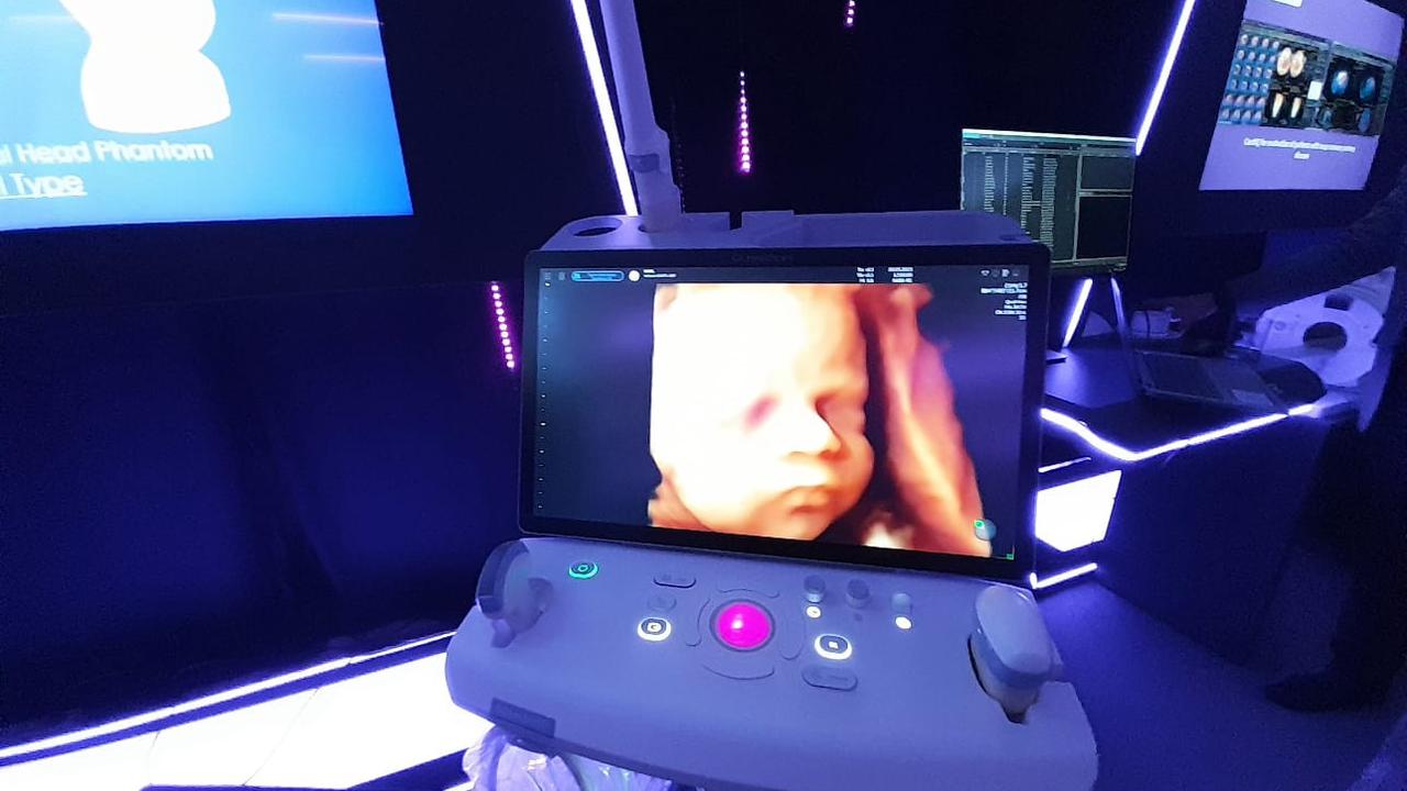 Training center ini diharapkan mampu membantu meningkatkan kapasitas dokter, perawat dan tenaga kesehatan di bidang teknologi medis termasuk USG.