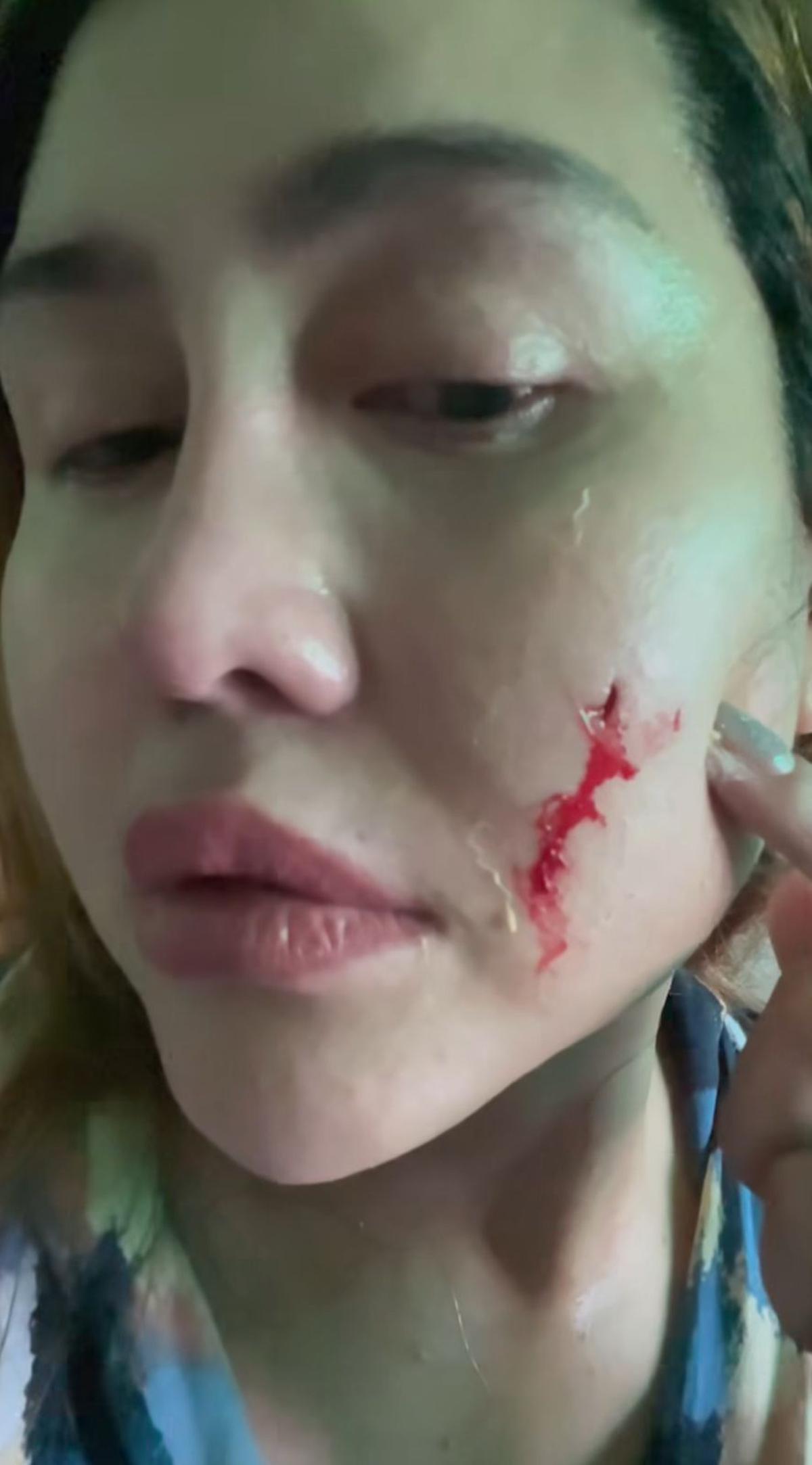 Pedangdut Ratu Meta Unggah Video Cekcok dengan Suami, Ungkap Kekerasan yang Diduga KDRT