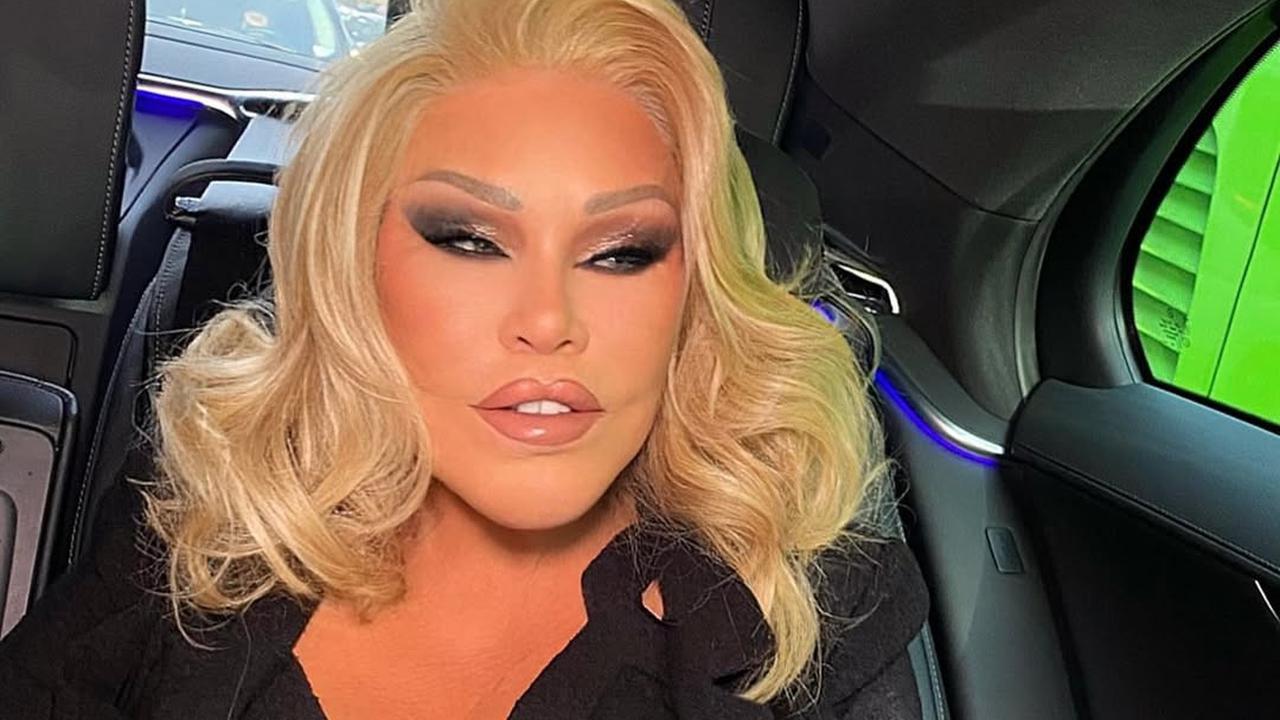 Jocelyn Wildenstein, Perempuan Berjuluk Catwoman Meninggal Dunia