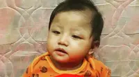 Sang Buah Hati Menyandang TORCH, Ibu Ini Berbagi Kisah Perjuangannya Sejak Hamil