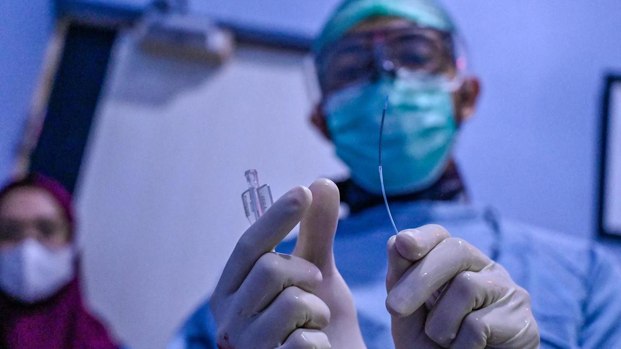 FOTO: Melihat Prosedur Pemasangan Stent Jantung di Banda Aceh