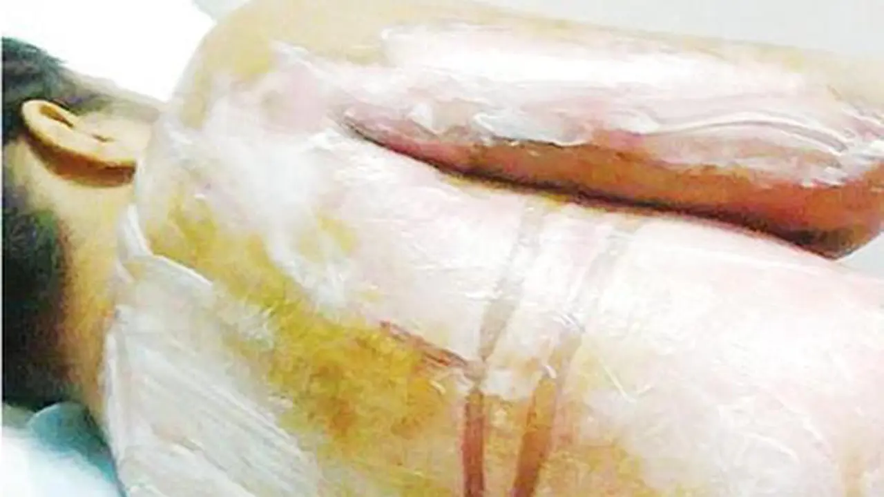 Karena Marah, Ibu Majikan Siksa Pekerja Rumah Tangga