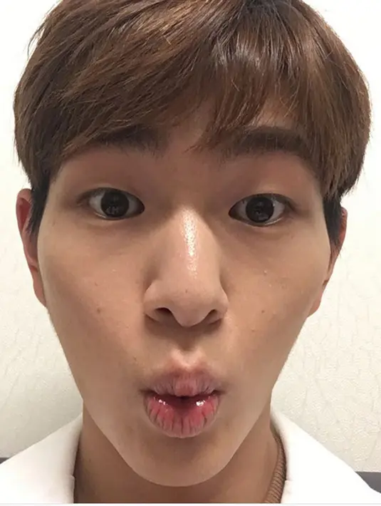 Sebentar lagi Onew akan bermain di dramanya yang berjudul Age of Youth 2. Ia akan menjadi seorang mahasiswa teknik yang buta akan cinta dan asmara. Di mata publik, setelah kasus ini Onew akan sulit menerima perannya. (Instagram/dlstmxkakwldrl)