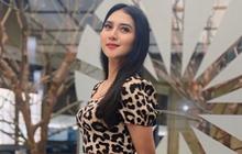 Aktris Sinetron Ini Laporkan Kekasih atas Dugaan Penganiayaan