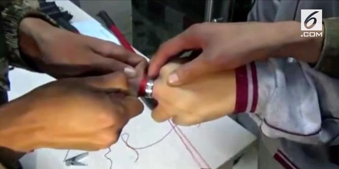VIDEO: Cincin Kecil Nyangkut di Jari Selama 10 Jam