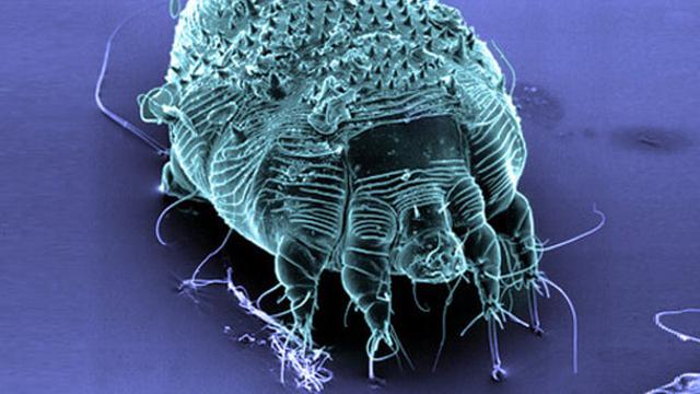 Scabies Adalah Infeksi Kulit, Kenali Tanda-Tanda dan Penyebabnya