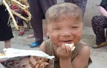 Bikin pilu, lima bocah ini menderita disiksa orangtua