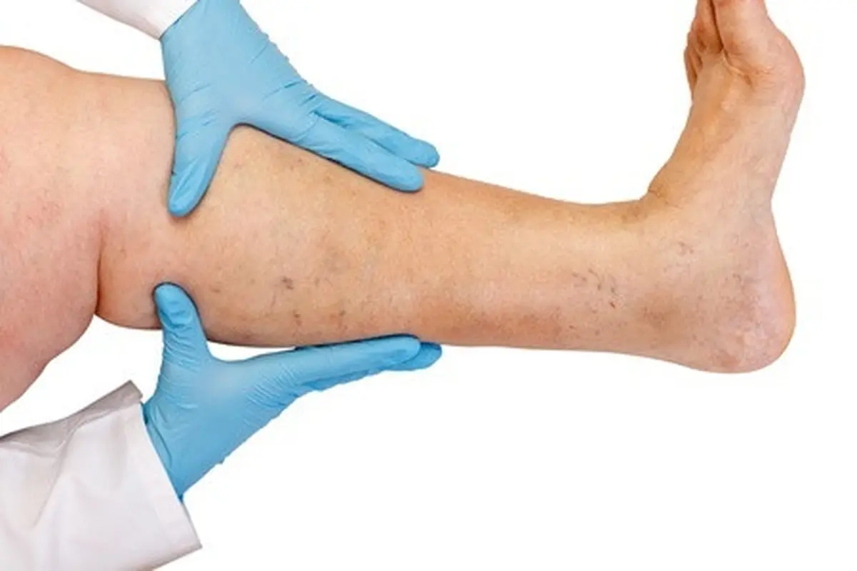 Simak, Cara Mengatasi Sakit Kaki Tengah Malam