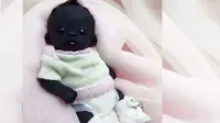 Bayi Berkulit Paling Legam Ini Gegerkan Publik di Socmed