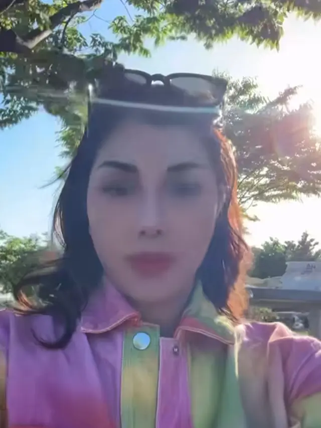 Nisya Ahmad Disebut Oplas di Korea