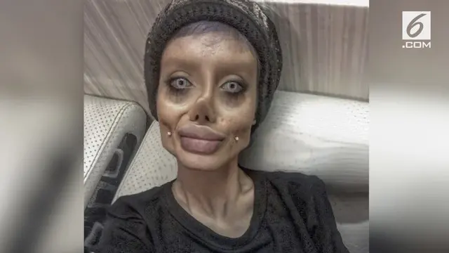 VIDEO: Demi Mirip Angelina Jolie, Wanita Ini 50 Kali Operasi Wajah