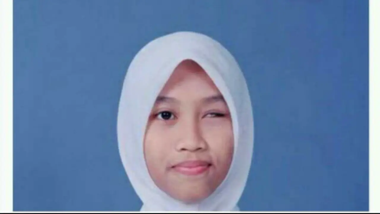 Bikin Haru, Ini Kisah Perempuan Bermata 1 yang Mencari Kerja