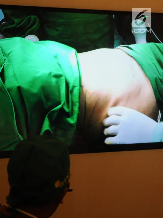 Mengintip Proses Bedah Plastik Liposuction di RS EMC Sentul