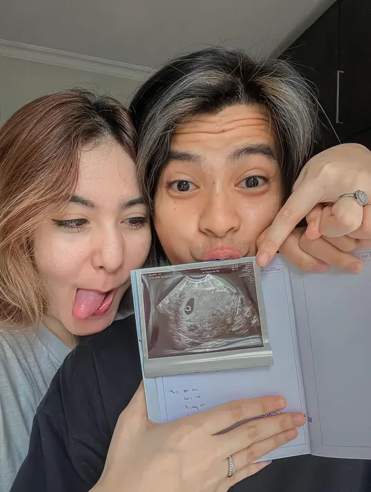 Arnold Leonard dan Moniq Crasivaya umumkan kabar kehamilan (Foto: Instagram arnoldleonard05)
