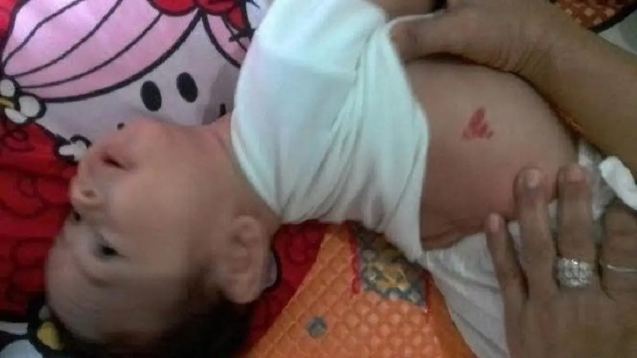Dikira Bintik Merah Biasa, Tanda Lahir Bayi Jambi Berlafaz Allah