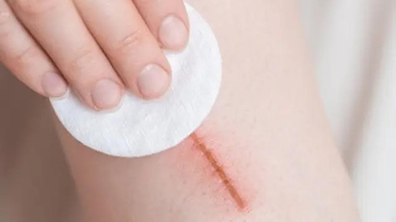 10 Manfaat Daun Bidara untuk Kesehatan Tubuh, Bantu Turunkan Kolesterol hingga Gula Darah