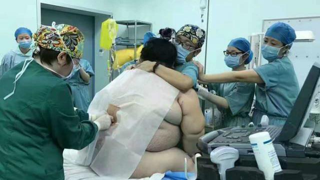 16 Petugas Medis Bantu Perjuangan Ibu Berbobot 127 Kg Melahirkan