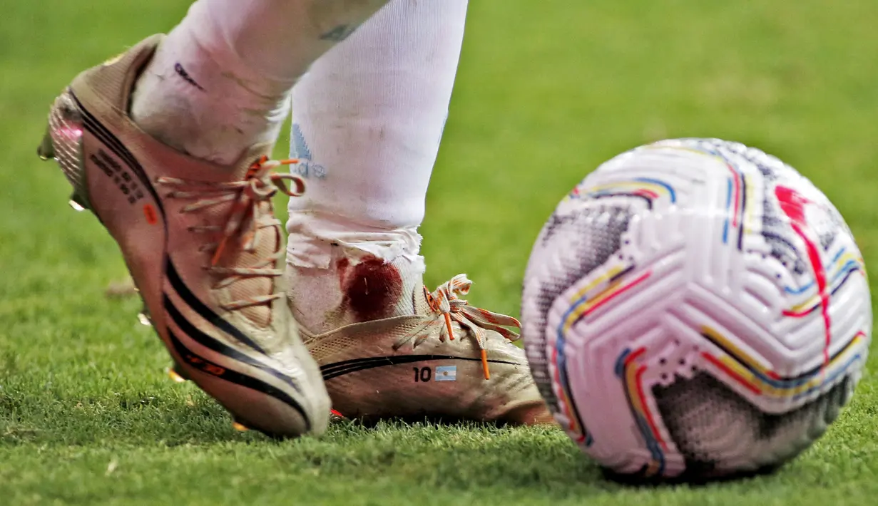 Tampak darah merembes dari kaus kaki Lionel Messi. (Foto:AFP/Silvio Avila)