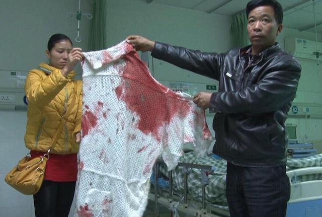 Keluarga menunjukkan pakaian penuh darah karena penusukan | Photo: Copyright shanghaiist.com