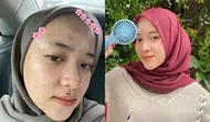 Potret Nissa Sabyan Pede Pamer Foto Berjerawat (Sumber: Instagram/nissa_sabyan)