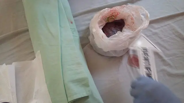 Barang bukti penganiayaan bayi oleh ibunya hingga meninggal dunia. (Foto: Liputan6.com/Polres Banyumas/Muhamad Ridlo)