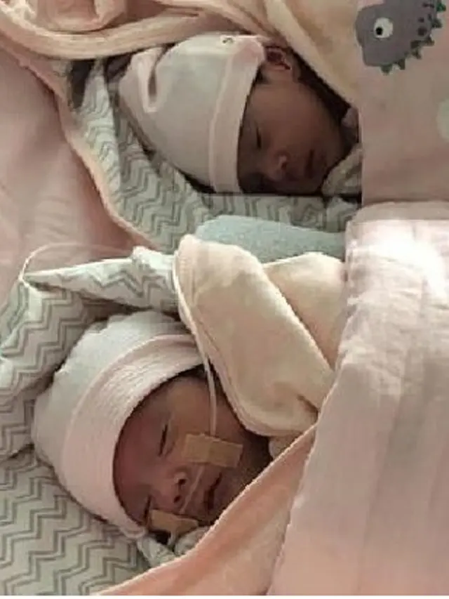 Viral, Rekaman USG Bayi Kembar Bertengkar dalam Rahim