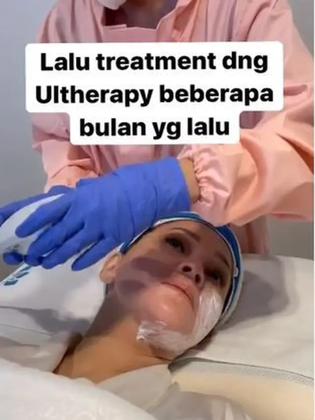 6 Potret Terbaru Maia Estianty Usai Suntik Botoks dan Laser, Banjir Pujian