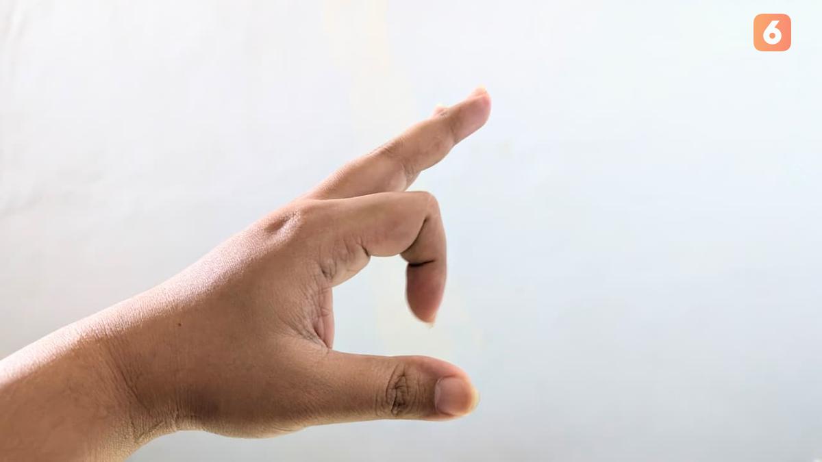 Mengenal Trigger Finger, Gejala hingga Cara Menanganinya