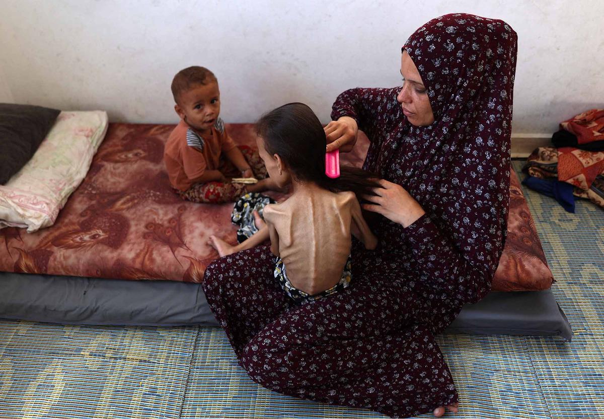 FOTO: Potret Pedih Mariam Anak 9 Tahun, Korban Kelaparan Gaza