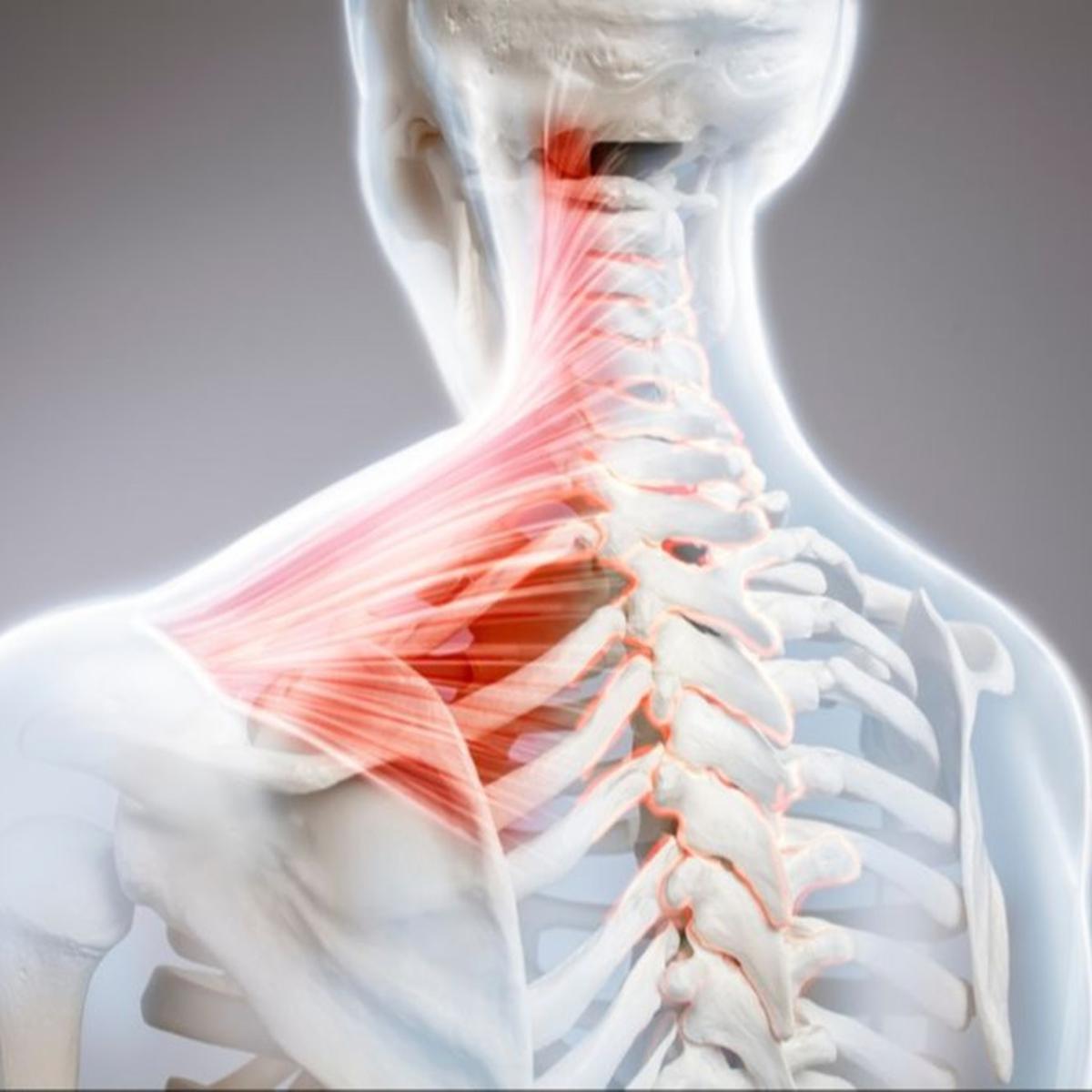 Sering Mengalami Nyeri Leher yang Menghambat Aktivitas? Cervical Disc Replacement Bisa Jadi Alternatif yang Tepat