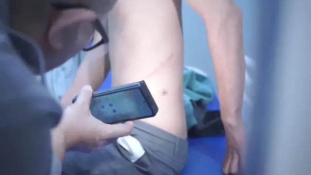 Salah satu korban Tindak Pidana Penjualan Orang (TPPO) mengakui kondisi tubuhnya masih dalam keadaan baik setelah menjalani proses transplantasi ginjal di Kamboja pada 25 Juni 2023. (Bachtiarudin Alam/Liputan6.com)