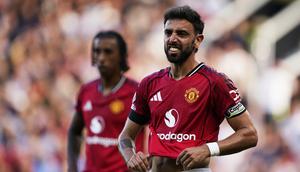 Ekspresi Bruno Fernandes pada laga Manchester United vs Arsenal di pekan ke-1 Premier League 2025/2026, Minggu (17/8) malam WIB - AP/Dave Thompson