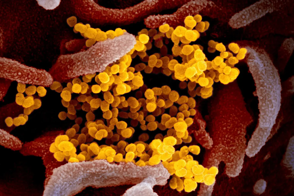 Virus Corona COVID-19 dari Mikroskop