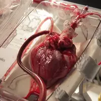 Mesin ini sanggup menghidupkan kembali jantung yang telah berhenti berdetak.