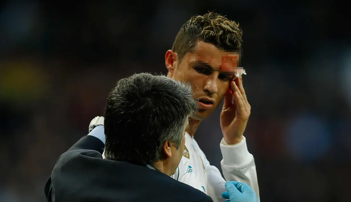 Cristiano Ronaldo menerima perawatan di kepalanya yang berdarah usai mencetak gol ke gawang Deportivo de la Coruna di La Liga Spanyol di Santiago Bernabeu, Madrid (21/1). Ronaldo mencetak dua gol pada menit ke 78 dan 84. (AP Photo/Francisco Seco)