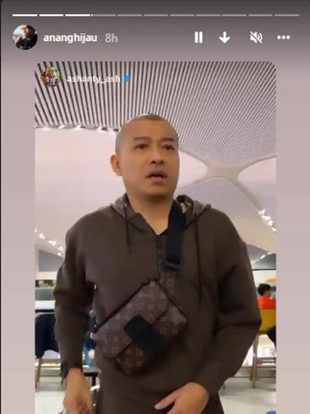 Dikira Raul Lemos, Ini 6 Potret Anang Hermansyah Usai Transplantasi Rambut di Turki