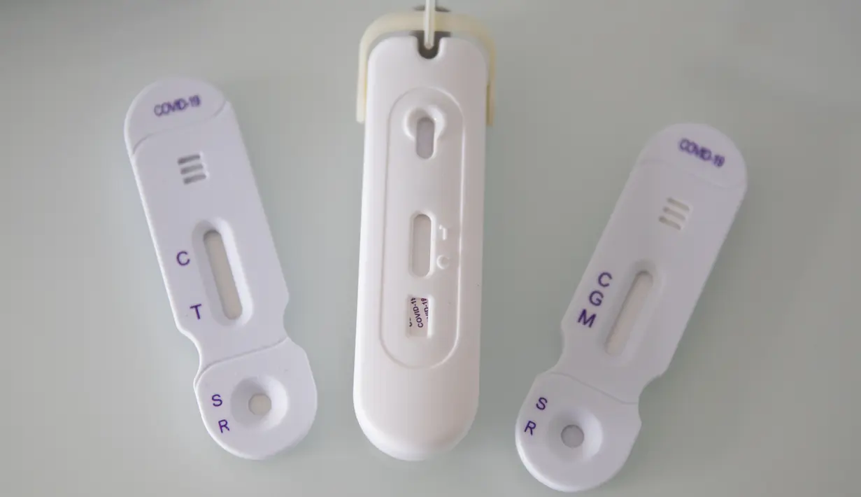 Tes COVID-19 digambarkan di NG Biotech, start-up pembuat berbagai tes medis, , termasuk kit COVID-19, di Guipry, Prancis pada 7 Januari 2022. Prancis memecahkan rekor infeksi harian tertinggi di Eropa membuat produsen bekerja keras memenuhi permintaan besar untuk tes. (AP Photo/Jeremias Gonzalez)
