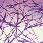 Bacillus anthracis, bakteri penyebab antraks (Wikipedia)