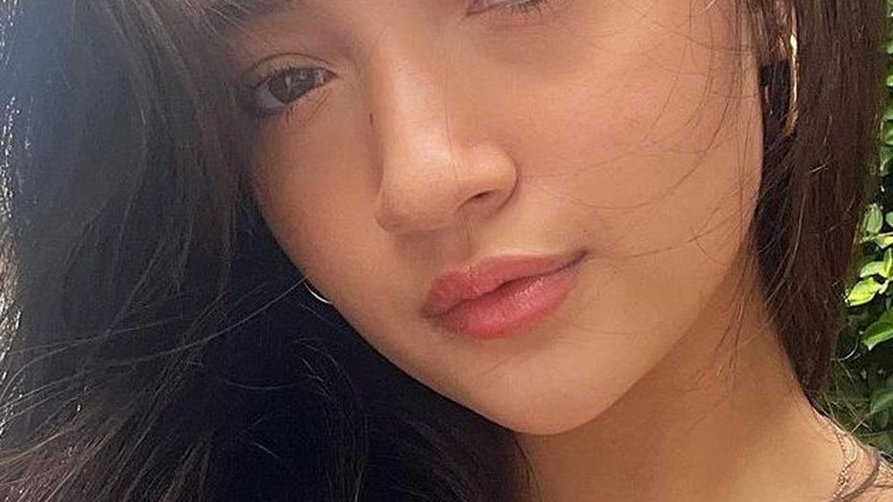 Dalam postingannya, Megan Domani juga menyemangati acne fighter lainnya. Dia menyadari bahwa setiap orang memang berbeda, tapi dia hanya ingin menceritakan cara yang berhasil untuknya.