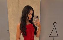 Niat Tampil Cantik Berujung Petaka, Influencer Asal Brasil Tewas Setelah Operasi Pembesaran Payudara