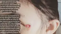 Kabar seorang siswa SMA Negeri di Kota Tasikmalaya yang menjadi korban penganiayaan teman sekolahnya viral di media sosial. (Liputan6.com/ Dok/ @Joelianaaaaa)