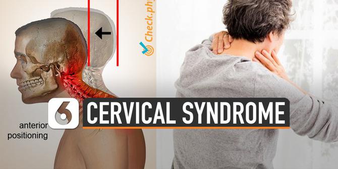 VIDEO: Waspada Cervical Syndrome, Karyawan Kebanyakan Duduk