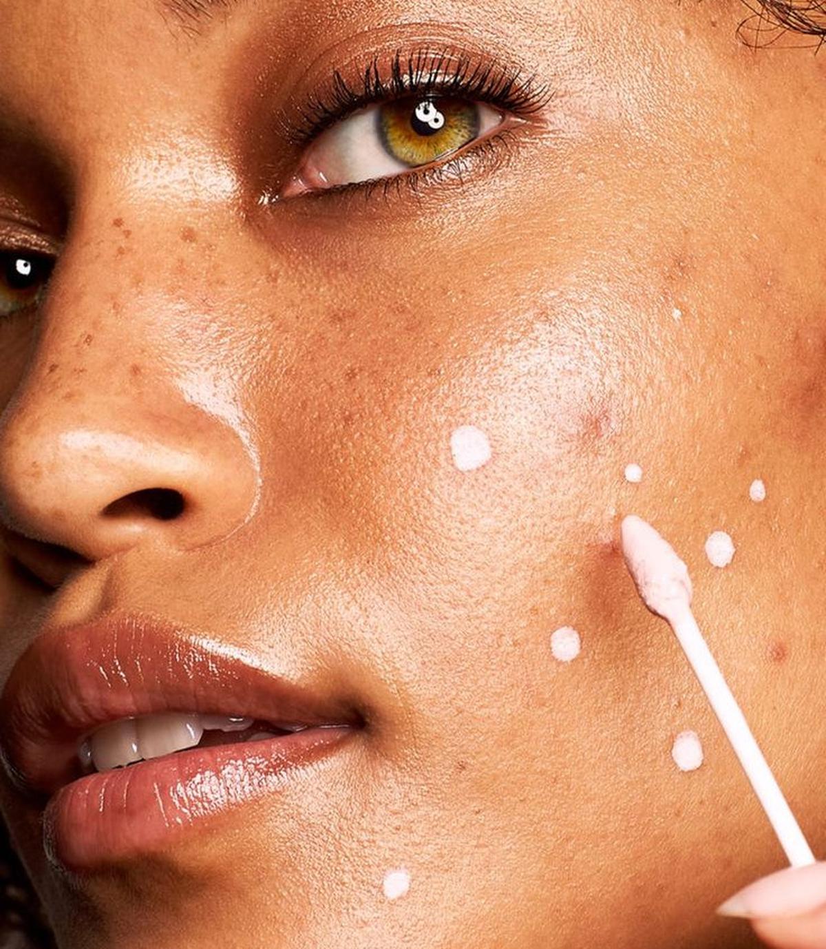 Punya Kulit Berjerawat? Simak Urutan Skincare Malam yang Paling Efektif untuk Hasil Maksimal