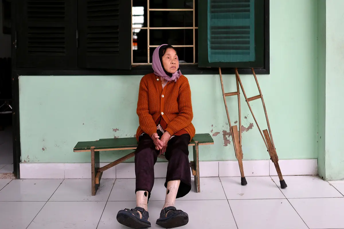 Kehidupan Para Penderita Kusta di Vietnam