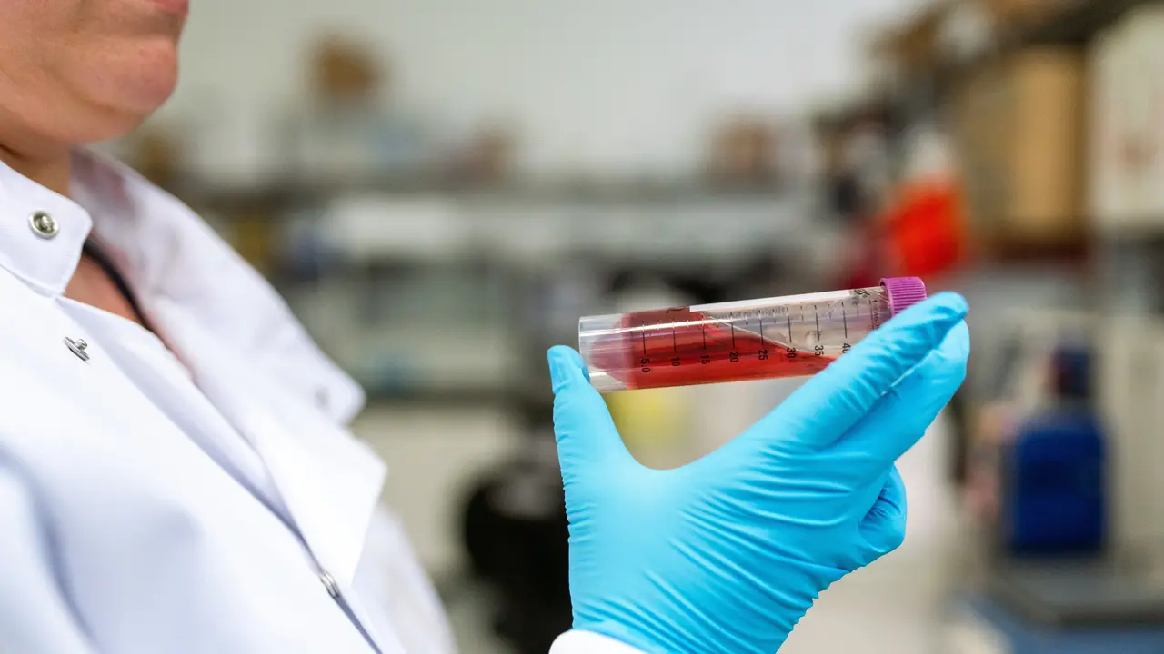 Ilustrasi Hemoglobin