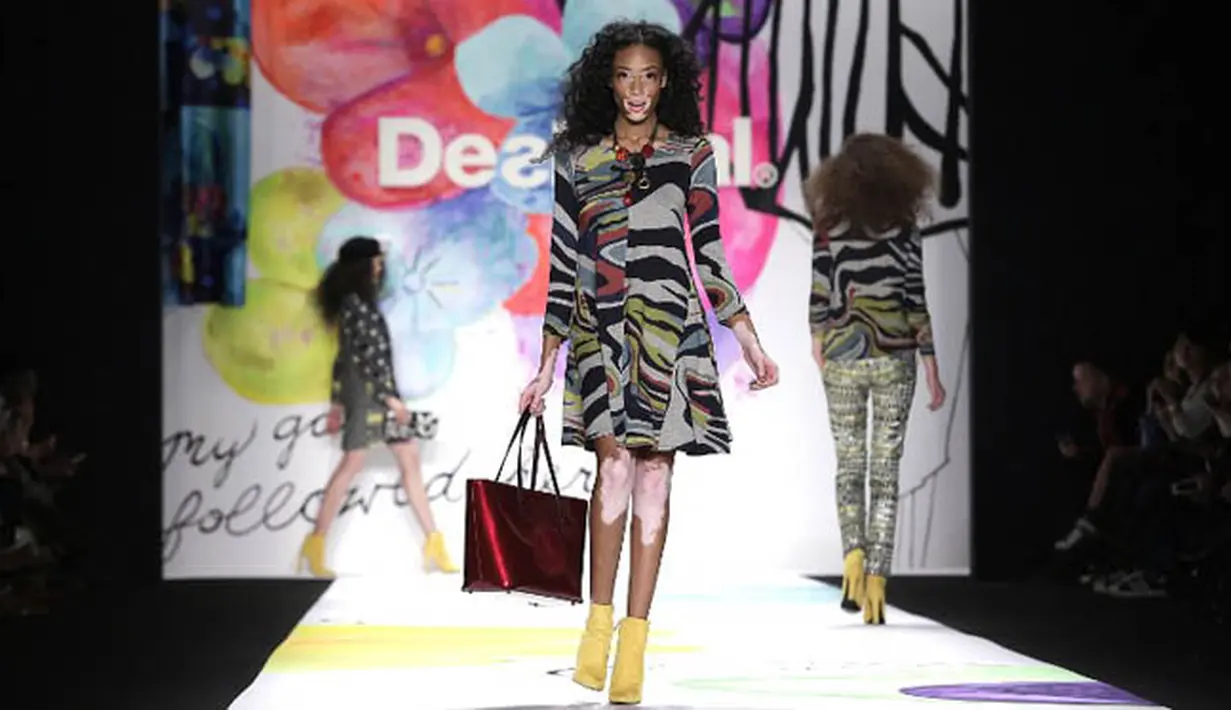 Model Winnie Harlow ketika beraksi di atas catwalk New York Fashion Week, Amerika Serikat, Kamis (12/2). (AFP PHOTO/JOSHUA LOTT)