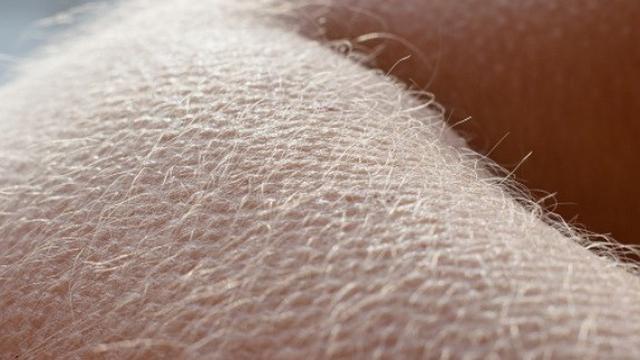 Ilustrasi Merinding (foto: Pixabay)