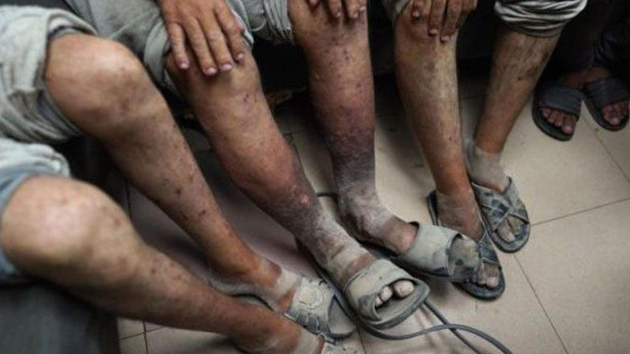 Temuan Lembaga Pengawas: Israel Sengaja Sebar Wabah Penyakit di Kalangan Tahanan Palestina